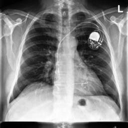 Synthetic chest X-ray generation